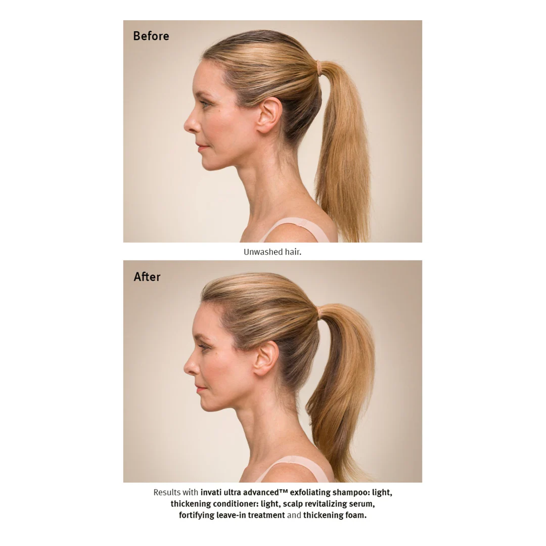 Aveda Invati Ultra Advanced Light Gift Set - Image 4