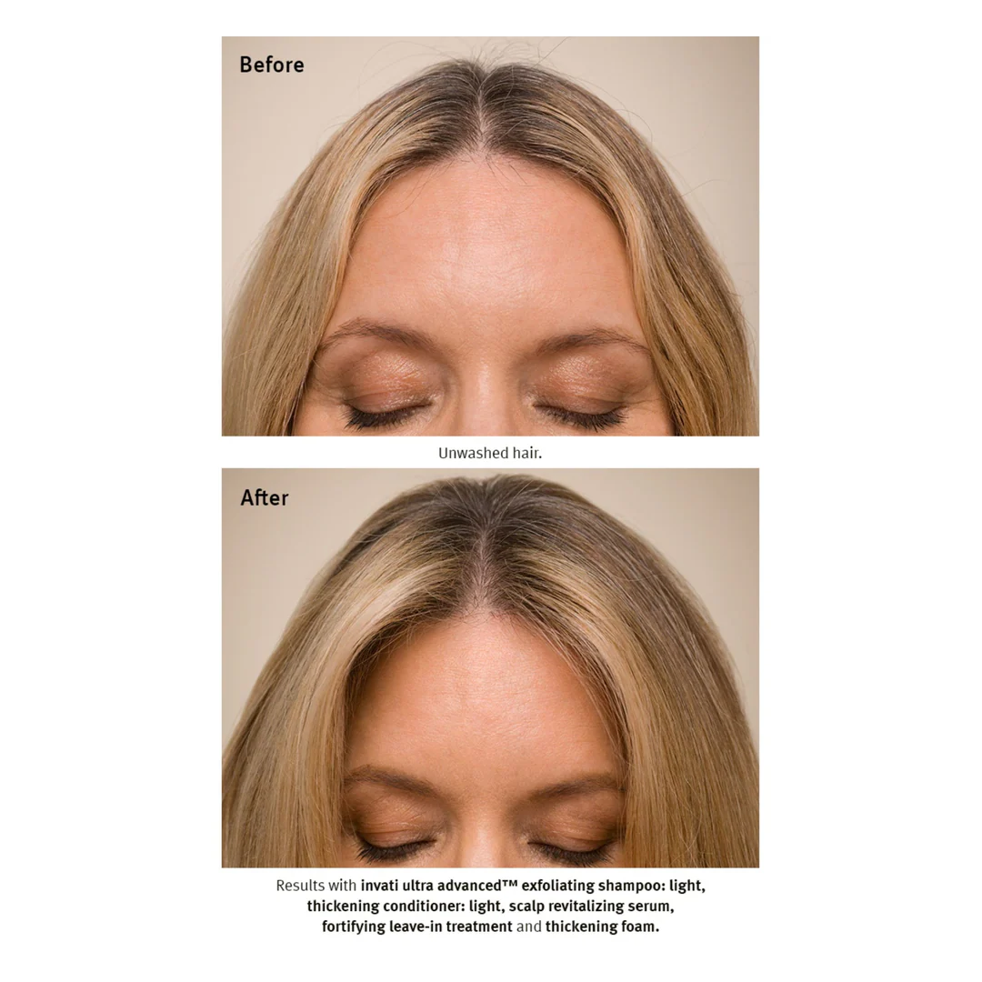 Aveda Invati Ultra Advanced Light Gift Set - Image 5