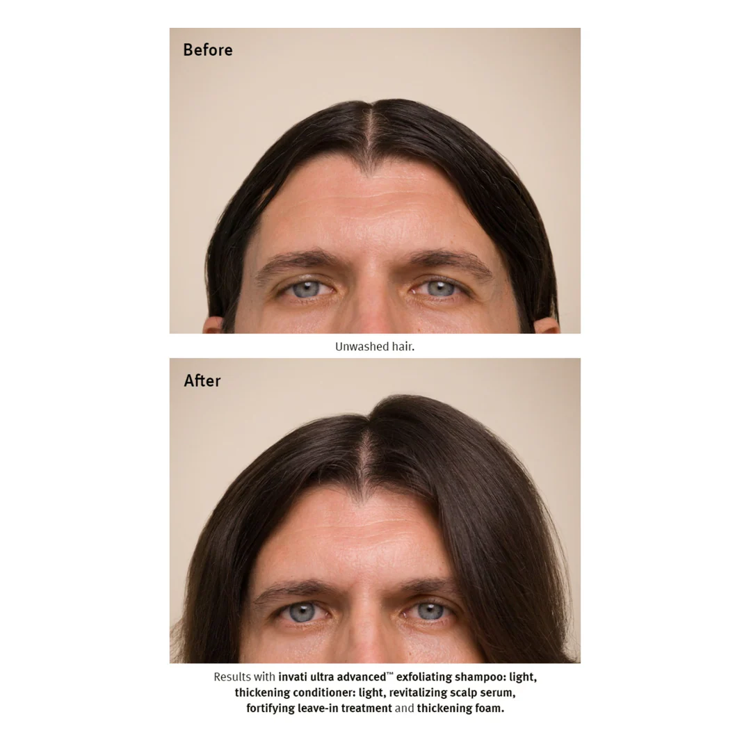 Aveda Invati Ultra Advanced Light Gift Set - Image 7