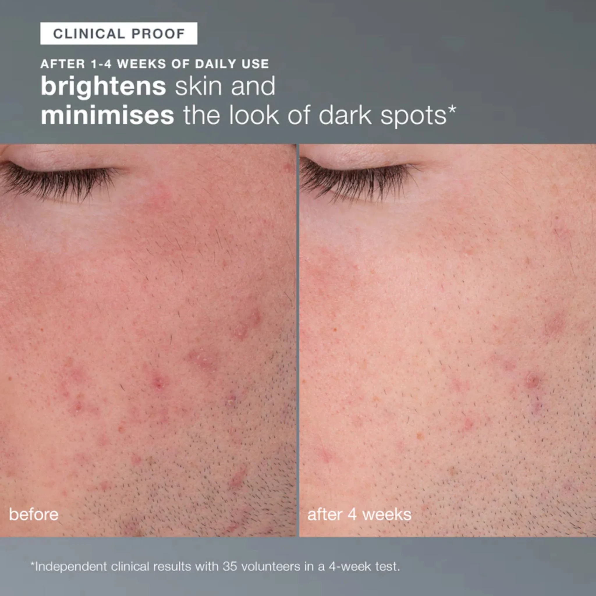 Dermalogica Daily Microfoliant - Image 7