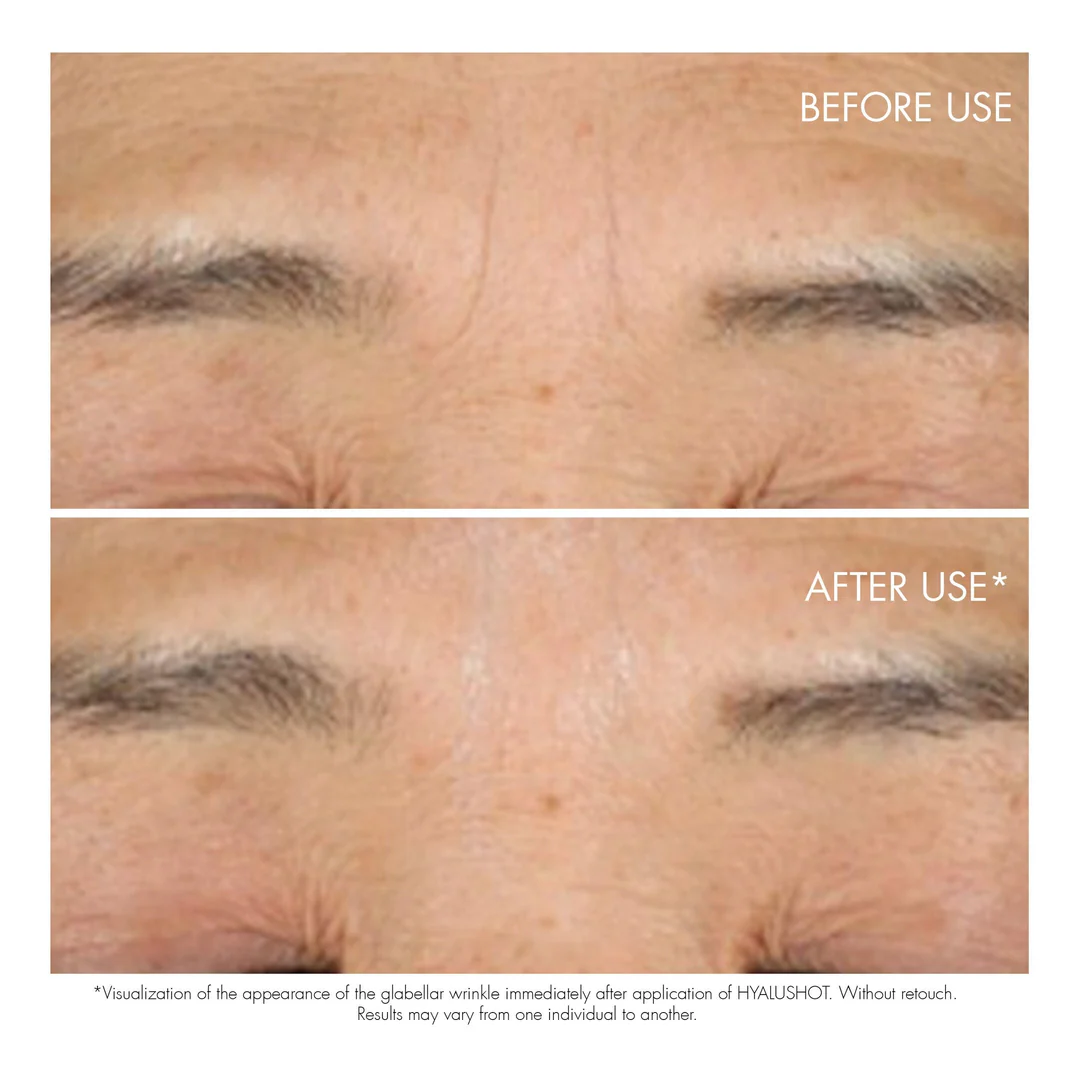 DIOR Capture Totale Hyalushot Wrinkle Corrector - Image 3