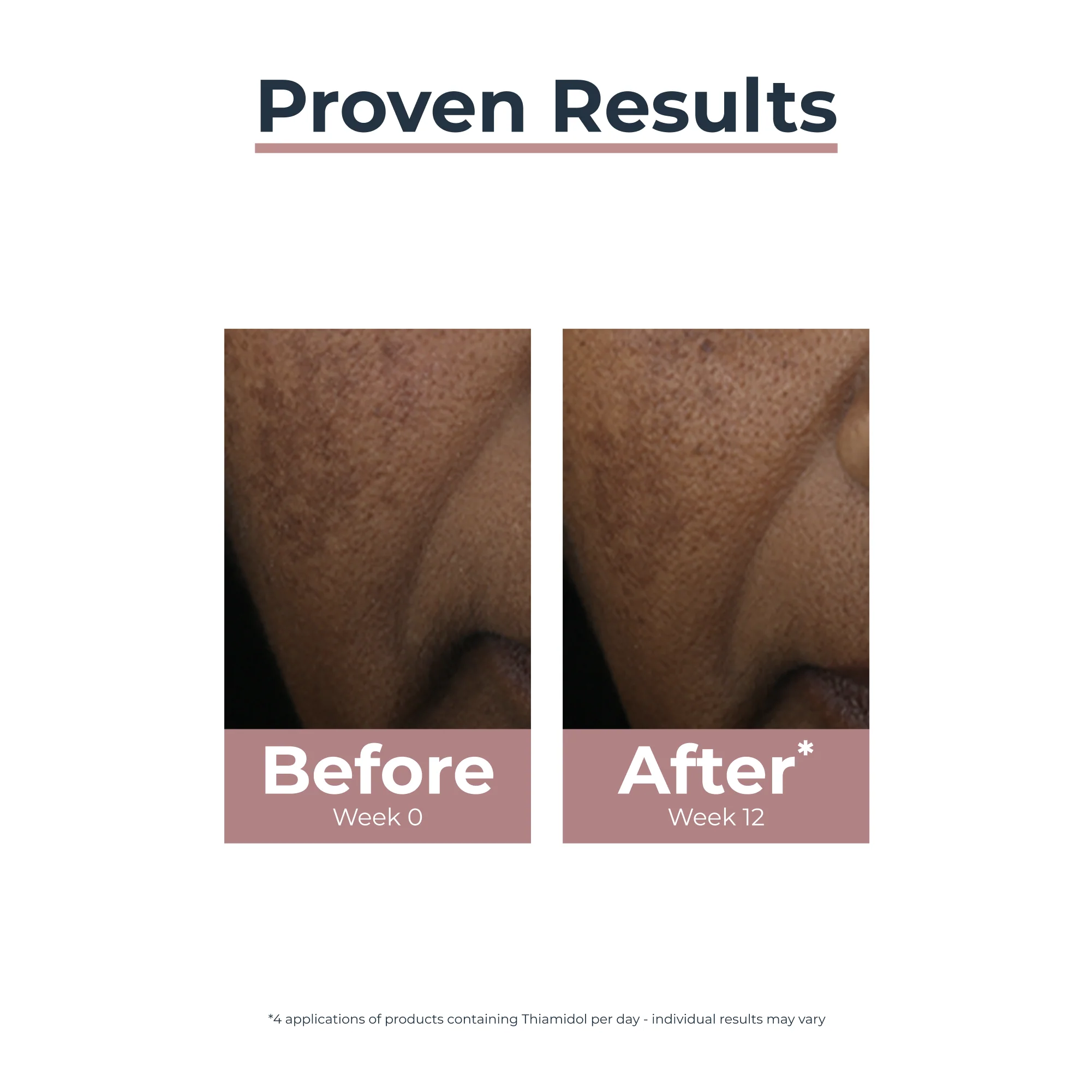 Eucerin Anti-Pigment Spot Corrector - Image 3