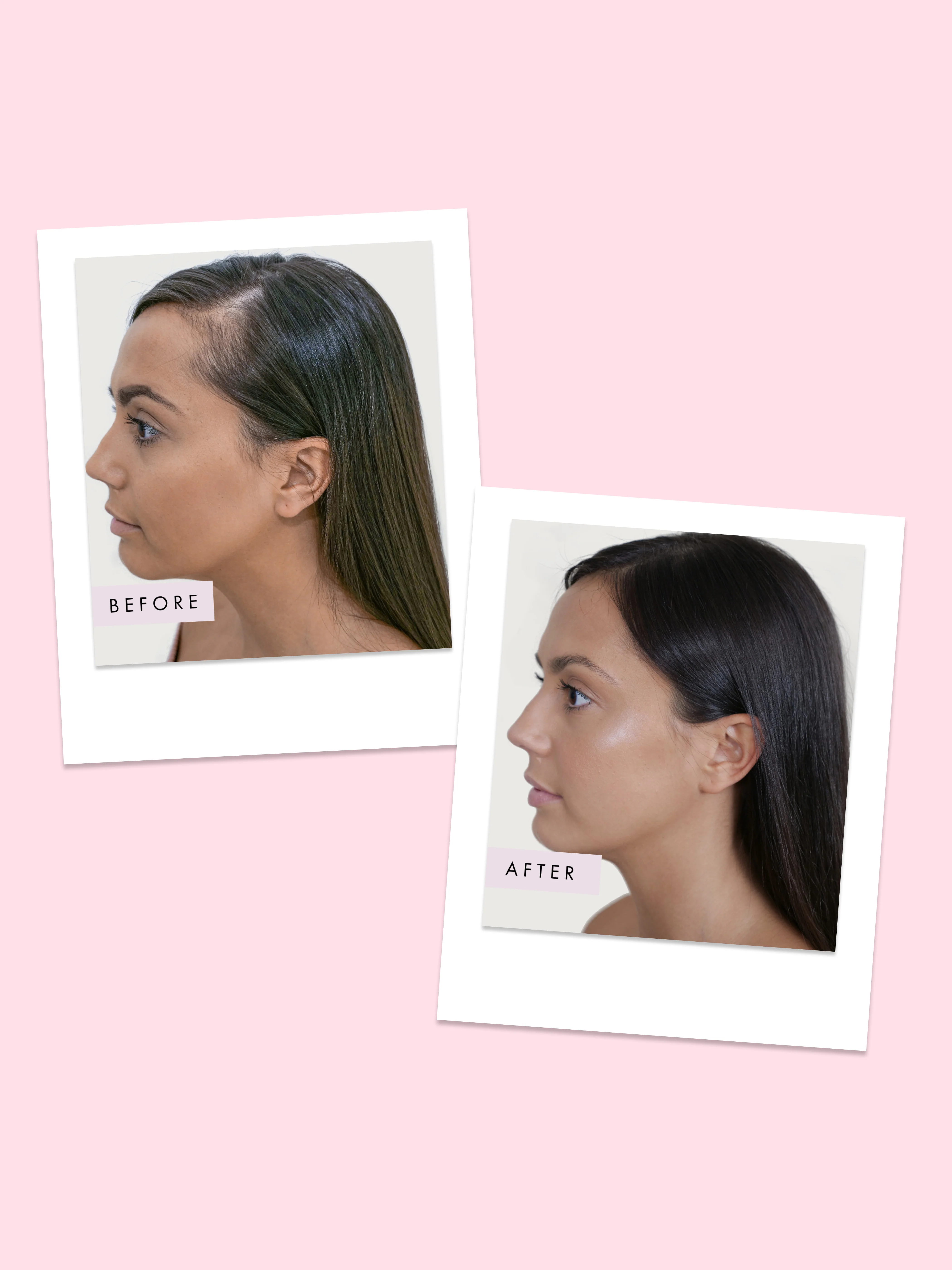 Hair Gain Vegan Hair Gummies x 60 - Image 5