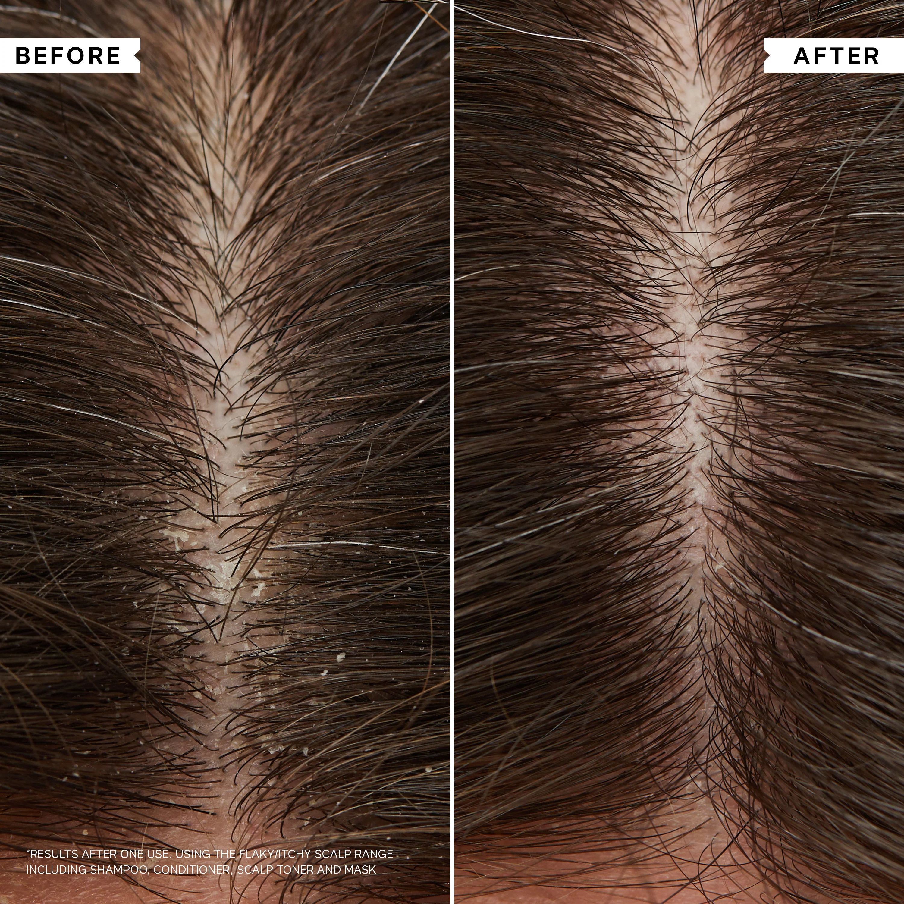 Philip Kingsley Flaky/Itchy Scalp Curl Shampoo - Image 10