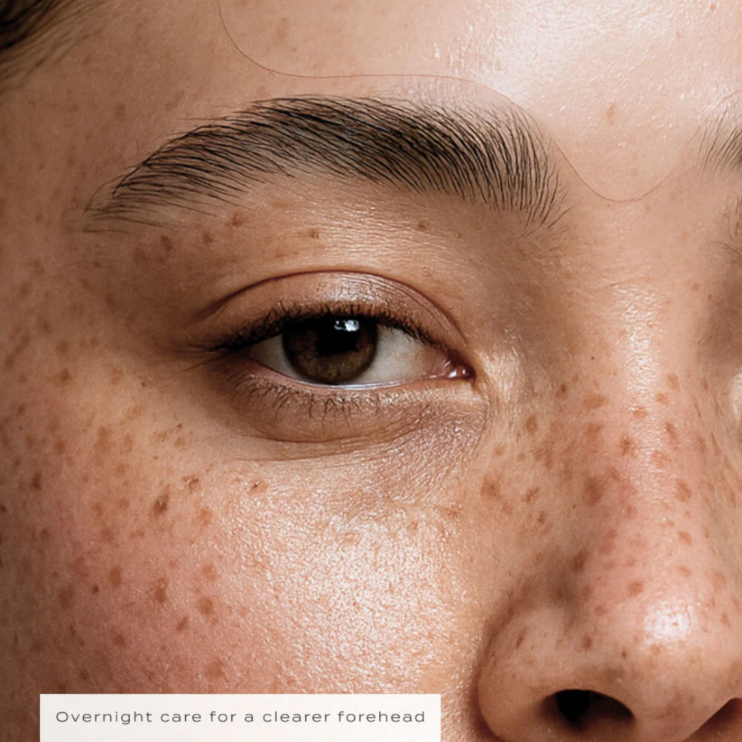 Vue Forehead Patches - Image 3