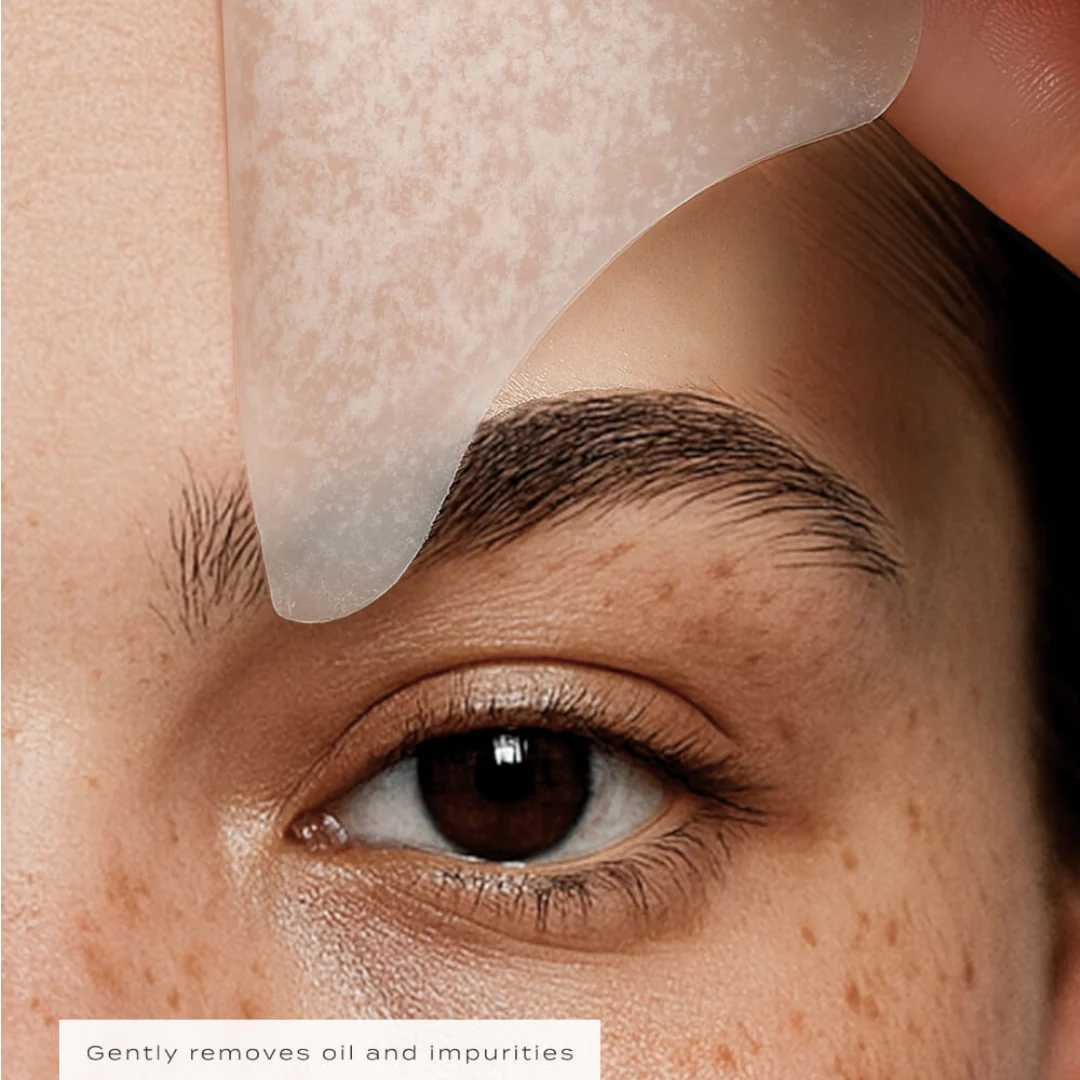 Vue Forehead Patches - Image 4